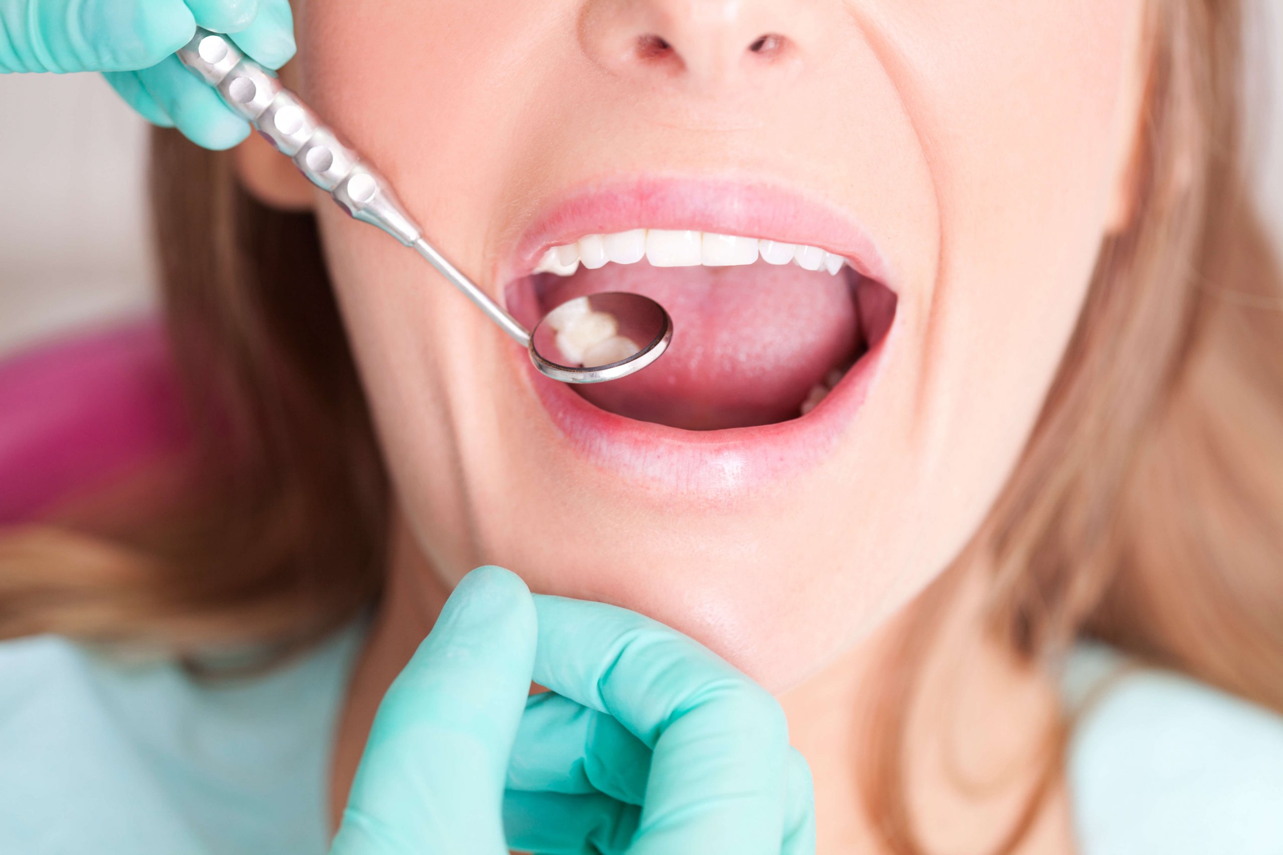 Oral Health 101: Cavities